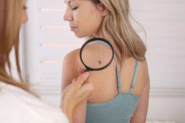 What Are Traditional Skin Lesion Removal Methods Bracknell?