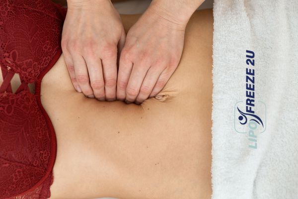 diastasis recti treatment Bracknell