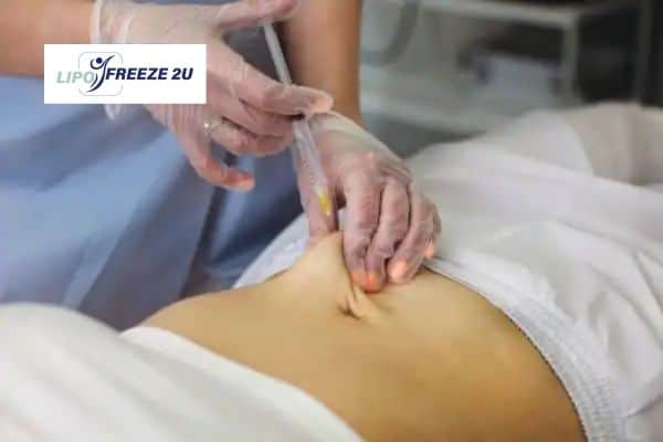 Fat Dissolving Injections Bracknell & Weight loss medication