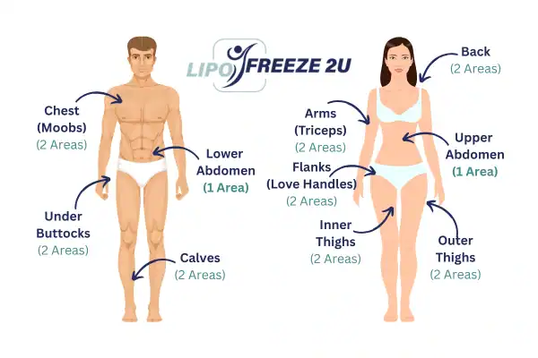 Areas you can have fat freezing treatment Bracknell