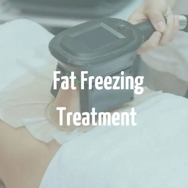 fat freezing treatment Bracknell
