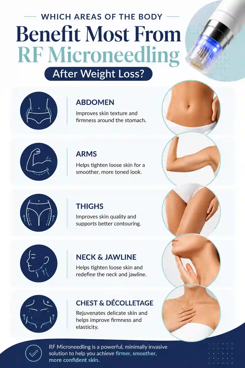 Which Areas of the Body Benefit Most From RF Microneedling After Weight Loss Bracknell